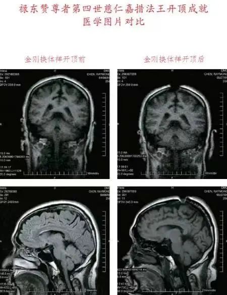 如果没有开顶，弟子百万也是凡夫一个! 第1张